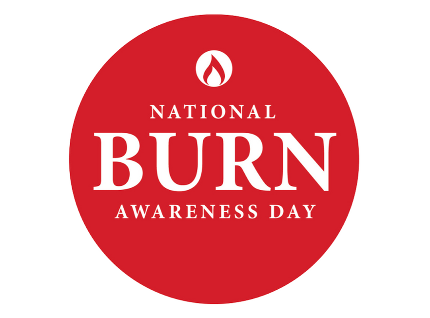 CosyPanda and national burn awareness day